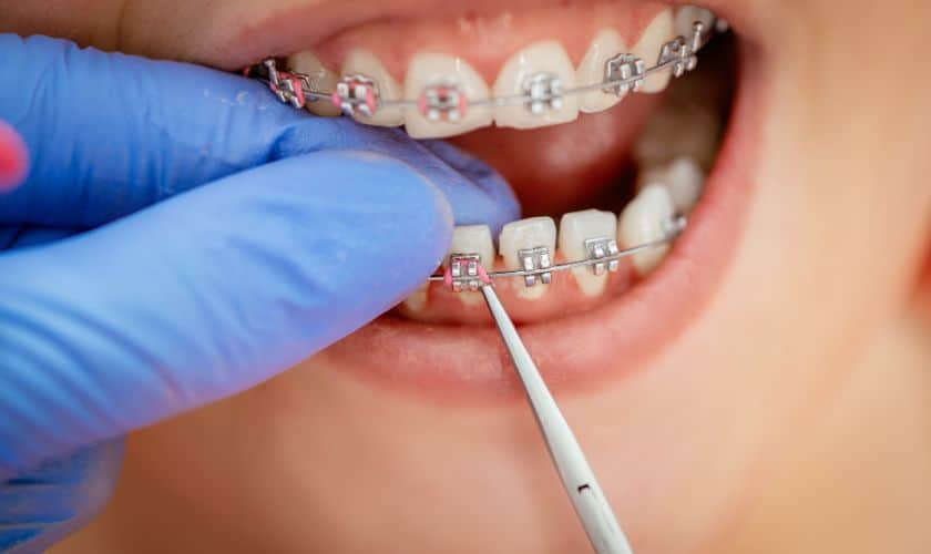 Orthodontist in Asheville: Setting New Standards of Excellence